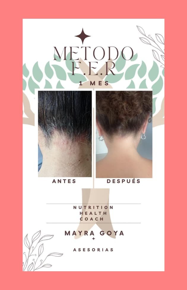 Antes y después Mayra 1