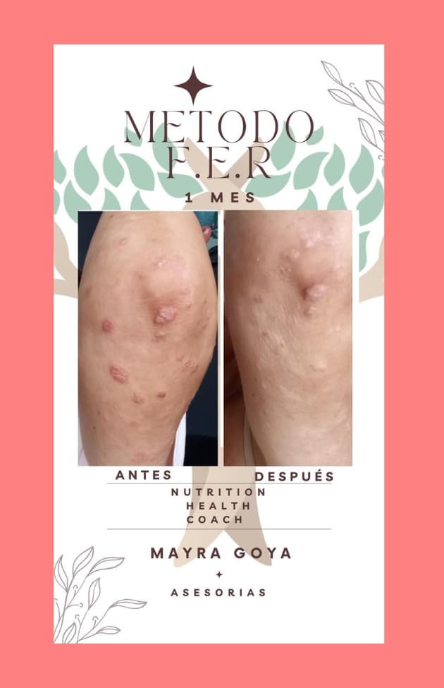 Antes y después Mayra 2