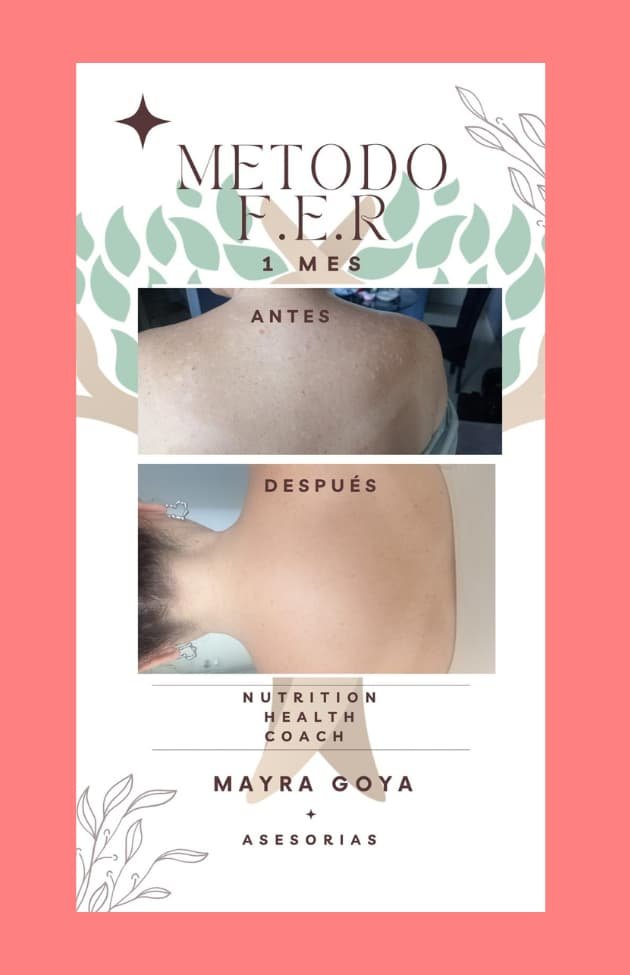 Antes y después Mayra 4