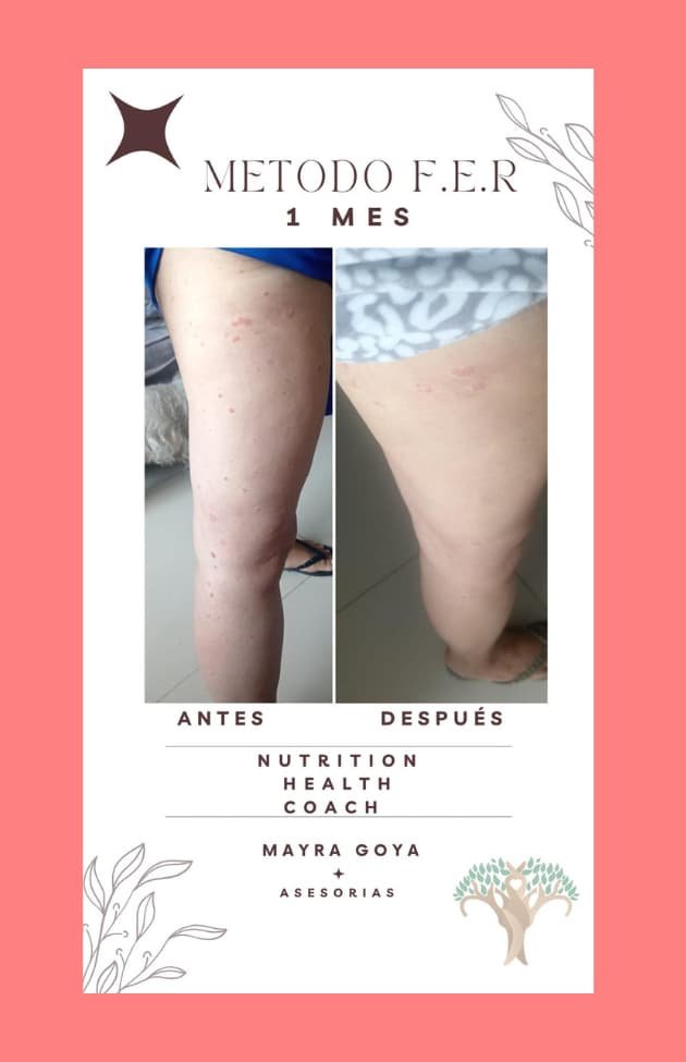 Antes y después Mayra 5