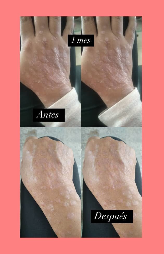 Antes y después Mayra 6