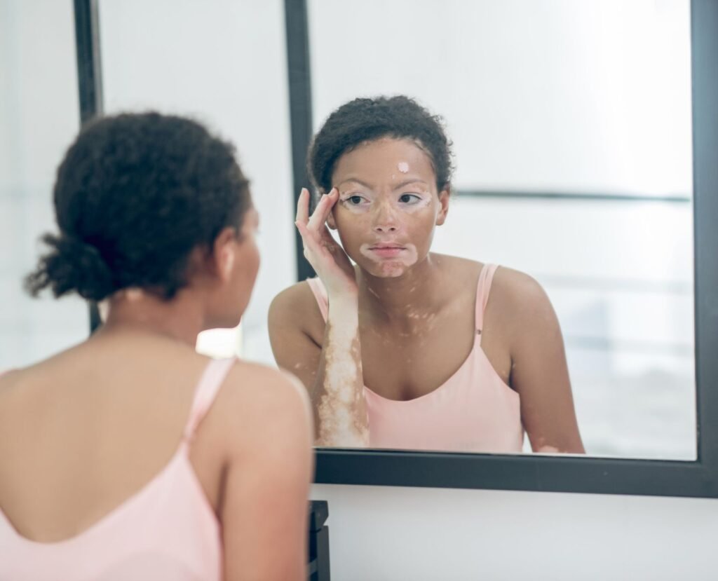 La salud va más allá de la piel