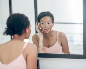 La salud va más allá de la piel